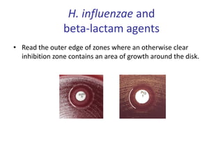 H. influenzae and
beta-lactam agents
• Read the outer edge of zones where an otherwise clear
inhibition zone contains an area of growth around the disk.
 