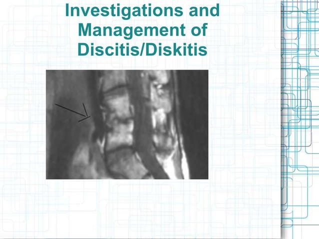 Diskitis | PPT | Bone and Joint Conditions | Diseases and Conditions