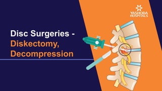 Disc Surgeries -
Diskectomy,
Decompression
 