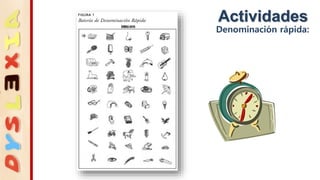 Actividades
Denominación rápida:
 