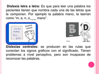 Dislexia letra a letra: Es que para leer una palabra los 
pacientes tienen que nombra cada una de las letras que 
la componen. Por ejemplo la palabra mano, la leerían 
como “m, a, n, o,___ mano”. 
Dislexias centrales: se producen en las rutas que 
conectan los signos gráficos con el significado. Tienen 
problemas a nivel perceptivo, pero son incapaces de 
reconocer las palabras. 
 