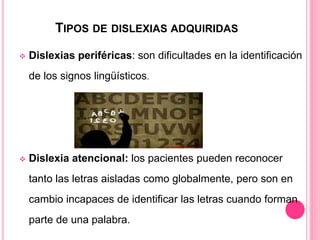 TIPOS DE DISLEXIAS ADQUIRIDAS 
 Dislexias periféricas: son dificultades en la identificación 
de los signos lingüísticos. 
 Dislexia atencional: los pacientes pueden reconocer 
tanto las letras aisladas como globalmente, pero son en 
cambio incapaces de identificar las letras cuando forman 
parte de una palabra. 
 