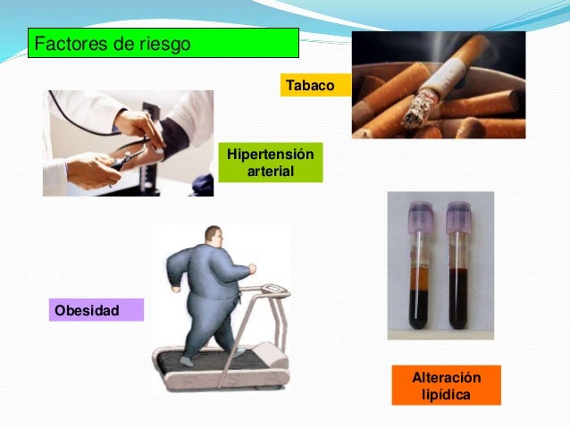 Dislipidemia Dislipidemia