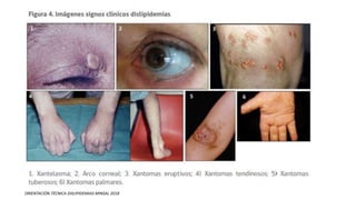 ORIENTACIÓN TÉCNICA DISLIPIDEMIAS MINSAL 2018
 