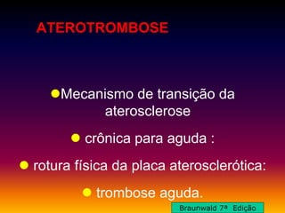 ATEROTROMBOSE
Mecanismo de transição da
aterosclerose
 crônica para aguda :
 rotura física da placa aterosclerótica:
 trombose aguda.
Braunwald 7ª Edição
 