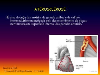 ATEROSCLEROSE
“É uma doença das artérias de grande calibre e de calibre
intermediário,caracterizada pelo desenvolvimento de placas
ateromatosas,na superficíe interna das paredes arteriais.”
Gyuton e Hall,
Tratado de Fisiologia Médica - 11ª edição
 