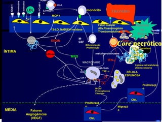 complexo
AC-Lipop.
LDL ox
LDL m. ox
complexo proteo-
glicanos-Lipop, MACRÓFAGO
MONÓCITO
“FOAM CELL”
Fatores de
crescimento
Migração
MÉDIA Fatores
Angiogênicos
C. M. L. A.
C. M. L. A.
F.C e Cito-
cinas
LINFÓCITO T
LINFÓCITO T
MONÓCITO
MCP-1
CSFs
Citocinas
ÍNTIMA
Moléc. de adesão
injúria endótelial
LDL
MONÓCITO /
MACRÓFAGO
RESIDENTE
R. L.
O’Brien, K.D. e Chait, A., 1994.
LOX-1
Diferenciação
Proliferação
CÉLULA
ESPUMOSA
Migraçã
o
MÉDIA Fatores
Angiogênicos
(VEGF)
CML
CML
Linfócito T
monócito
MCP-1
apoptos
e
ÍNTIMA
2integrin
a
LDL
MACRÓFAGO
LUMEN
LDL
LDL
mm
LDLox
ICAM-1
P-selectina
E-selectina
P-VCAM-1
VLA-4
PCAM-1
M-
CSF
proteoglicanos
12-LO, NAD(P)H oxidase
MPO
ERON
CD36
CD68
SRA
M-CSF
Proteoglicanos
Citocinas
Proliferaçã
o
TNF-
(-)
(+)
IFN-
CD40-CD40L
Lípides extracelulares
debris celulares
COx necrose
calcificação
Cápsula
fibrosa
Core necrótico
metaloproteinases
TROMBO
Ruptura
da
Placa
Proliferaçã
o
Fator tissular
Ativ.Plasminogênio
Trombomodulina
 