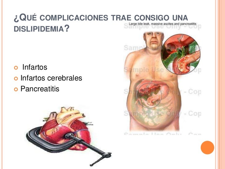 Adelgazar como el mecánico
