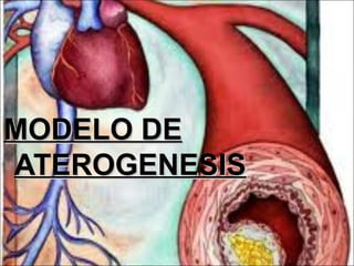 MODELO DE
ATEROGENESIS
 