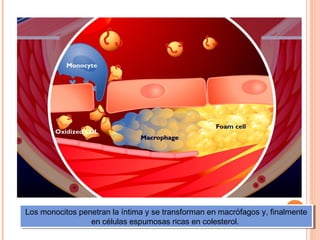Los monocitos penetran la íntima yyse transforman en macrófagos y, finalmente
 Los monocitos penetran la íntima se transforman en macrófagos y, finalmente
                 en células espumosas ricas en colesterol.
                  en células espumosas ricas en colesterol.
 
