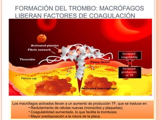 FORMACIÓN DEL TROMBO: MACRÓFAGOS
 LIBERAN FACTORES DE COAGULACIÓN




Los macrófagos activados llevan a un aumento de producción TF, que se traduce en:
         • Reclutamiento de células nuevas (monocitos y plaquetas);
         • Coagulabilidad aumentado, lo que facilita la trombosis;
         • Mayor predisposición a la rotura de la placa.
 