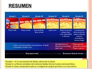 RESUMEN




••GradosI I- -IV: la acumulación de lípidos, dentro de la célula;
 Grados        IV: la acumulación de lípidos, dentro de la célula;
••GradoV: La fibrosis alrededor del núcleo de lípidos forman la placa aterosclerótica;
 Grado V: La fibrosis alrededor del núcleo de lípidos forman la placa aterosclerótica;
••GradoVI: placa complicada (ruptura, oocoágulo de sangre) que lleva aaun caso clínico.
 Grado VI: placa complicada (ruptura, coágulo de sangre) que lleva un caso clínico.
 