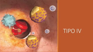 NOMBRES ALTERNATIVOS
•Hiperlipoproteinemia tipo IV
•Hiperlipemia inducida por carbohidratos
Referencia: Online Mendelian I...