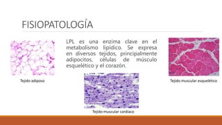 FISIOPATOLOGÍA
LPL es una enzima clave en el
metabolismo lipídico. Se expresa
en diversos tejidos, principalmente
adipocit...
