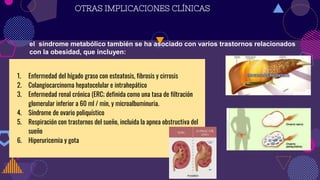 OTRAS IMPLICACIONES CLÍNICAS
el síndrome metabólico también se ha asociado con varios trastornos relacionados
con la obesidad, que incluyen:
1. Enfermedad del hígado graso con esteatosis, fibrosis y cirrosis
2. Colangiocarcinoma hepatocelular e intrahepático
3. Enfermedad renal crónica (ERC; definida como una tasa de filtración
glomerular inferior a 60 ml / min, y microalbuminuria.
4. Síndrome de ovario poliquístico
5. Respiración con trastornos del sueño, incluida la apnea obstructiva del
sueño
6. Hiperuricemia y gota
 