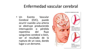 Enfermedad vascular cerebral
• Un Evento Vascular
Cerebral (EVC), puede
ocurrir cuando una arteria
se obstruye produciendo
interrupción o pérdida
repentina del flujo
sanguíneo cerebral o bien,
ser el resultado de la
ruptura de un vaso, dando
lugar a un derrame.
 