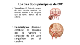Los tres tipos principales de EVC
• Trombótico: El flujo de sangre
de una arteria cerebral se
bloquea debido a un coágulo
que se forma dentro de la
arteria.
• Hemorrágico: (derrame
cerebral) es causado
por la ruptura y
sangrado de un vaso
sanguíneo en el
cerebro.
 