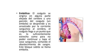 • Embólico: El coágulo se
origina en alguna parte
alejada del cerebro y una
porción del coágulo (un
émbolo) se desprende y es
arrastrado por la corriente
sanguínea al cerebro, el
coágulo llega a un punto que
es lo suficientemente
estrecho como para no
poder continuar y tapa el
vaso sanguíneo, cortando el
abastecimiento de sangre.
Este bloque súbito se llama
embolia.
 