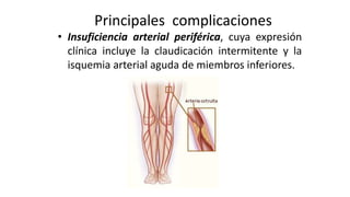 Principales complicaciones
• Insuficiencia arterial periférica, cuya expresión
clínica incluye la claudicación intermitente y la
isquemia arterial aguda de miembros inferiores.
 