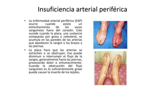 Insuficiencia arterial periférica
• La enfermedad arterial periférica (EAP)
ocurre cuando existe un
estrechamiento de los vasos
sanguíneos fuera del corazón. Esto
sucede cuando la placa, una sustancia
compuesta por grasa y colesterol, se
acumula en las paredes de las arterias
que abastecen la sangre a los brazos y
las piernas.
• La placa hace que las arterias se
estrechen o se obstruyan. Eso puede
disminuir o interrumpir el flujo de la
sangre, generalmente hacia las piernas,
provocando dolor o entumecimiento.
Cuando la obstrucción del flujo
sanguíneo es lo suficientemente grave
puede causar la muerte de los tejidos.
 