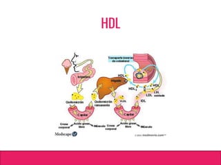 HDL
 