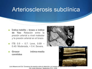 Arteriosclerosis subclínica
S Índice tobillo – brazo o índice
de Yao: Relación entre la
presión arterial a nivel maleolar
y la presión arterial en el brazo.
S ITB 0.9 – 0.7: Leve, 0.69 –
0.40: Moderada, < 0.4: Severa.
S Grosor intima-media
carotidea
Lluìs Masana and Col. Consenso de expertos sobre la detección y el manejo de hipercolesterolemia famiiar.
Clin invest Arterioscl. Septiembre 2013. 25/4)
 