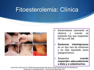 Fitoesterolemia: Clínica
• Xantomatosis raramente se
observa y cuando se
presenta hay que sospechar
HF Ho o HF AR.
• Xantomas intertriginosos
es un tipo rara de xantomas
y ha sido reportado como
patognomónico.
• Sospechar cuando
responden adecuadamente
a dieta y a colestiramina.
Joong Heum Park and Col. Sitosterolemia presenting with severe hypercholesterolemia and intertrigninus
xanthomas in a breastfed infant. J. Clind Enocrin Mett. May 2014
 