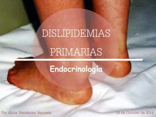 DISLIPIDEMIAS 
PRIMARIAS 
Endocrinología 
Por Alicia Hernández Retureta 14 de Octubre de 2014 
 