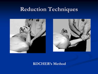 Reduction TechniquesKOCHER’s Method