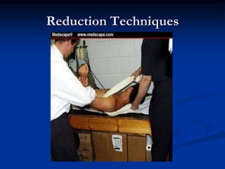 Reduction Techniques