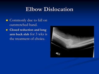 Hip DislocationAfter TreatmentThe patient is put on surface traction for three weeks.Full weight bearing is permitted after 6 wks.