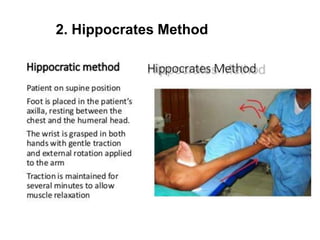 Joint Dislocation | PPTX
