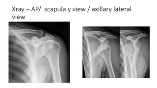 dislocation.pptx