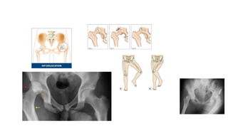 dislocation.pptx