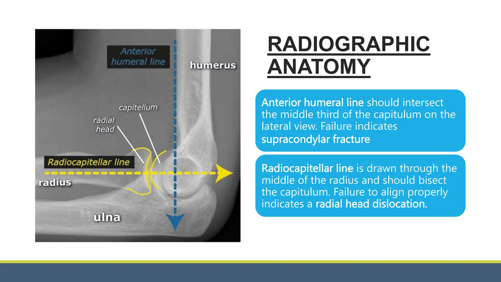hip, shoulder and elbow dislocation.pptx
