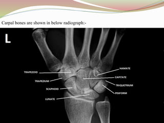 Carpal bones are shown in below radiograph:-
 