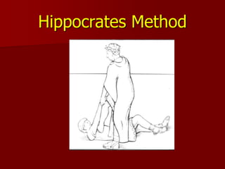 dislocation and subluxation 3.ppt