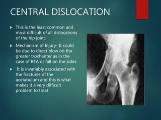 CENTRAL DISLOCATION
 This is the least common and
most difficult of all dislocations
of the hip joint.
 Mechanism of Injury- It could
be due to direct blow on the
greater trochanter as in the
case of RTA or fall on the sides
 It is invariably associated with
the fractures of the
acetabulum and this is what
makes it a very difficult
problem to treat
 