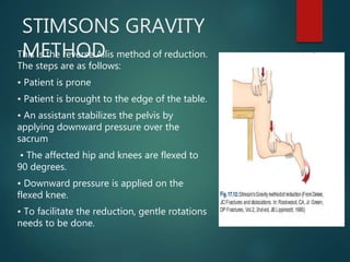 STIMSONS GRAVITY
METHODThis is the reverse Allis method of reduction.
The steps are as follows:
• Patient is prone
• Patient is brought to the edge of the table.
• An assistant stabilizes the pelvis by
applying downward pressure over the
sacrum
• The affected hip and knees are flexed to
90 degrees.
• Downward pressure is applied on the
flexed knee.
• To facilitate the reduction, gentle rotations
needs to be done.
 