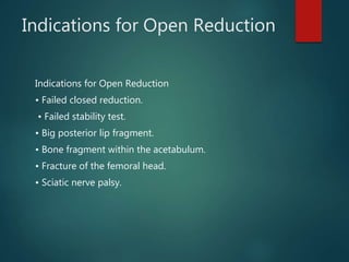 Indications for Open Reduction
Indications for Open Reduction
• Failed closed reduction.
• Failed stability test.
• Big posterior lip fragment.
• Bone fragment within the acetabulum.
• Fracture of the femoral head.
• Sciatic nerve palsy.
 