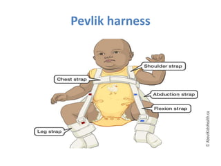 Pevlik harness
 
