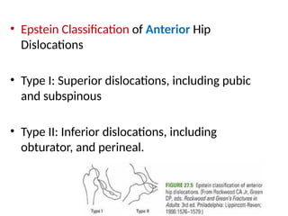 DISLOCATION OF HIP AND KNEE.pptxnnhhjjjjjj | PPTX