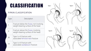Dislocation of hip joint | PPTX