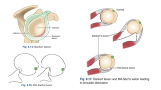 MBBS ORTHOPAEDICS Dislocation of Joints.pptx