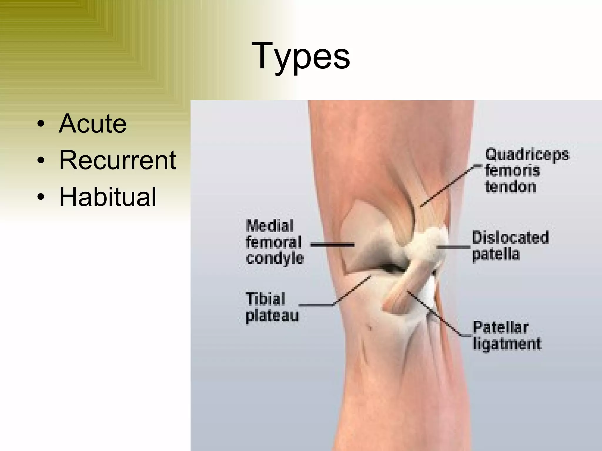 Types Acute Recurrent Habitual 