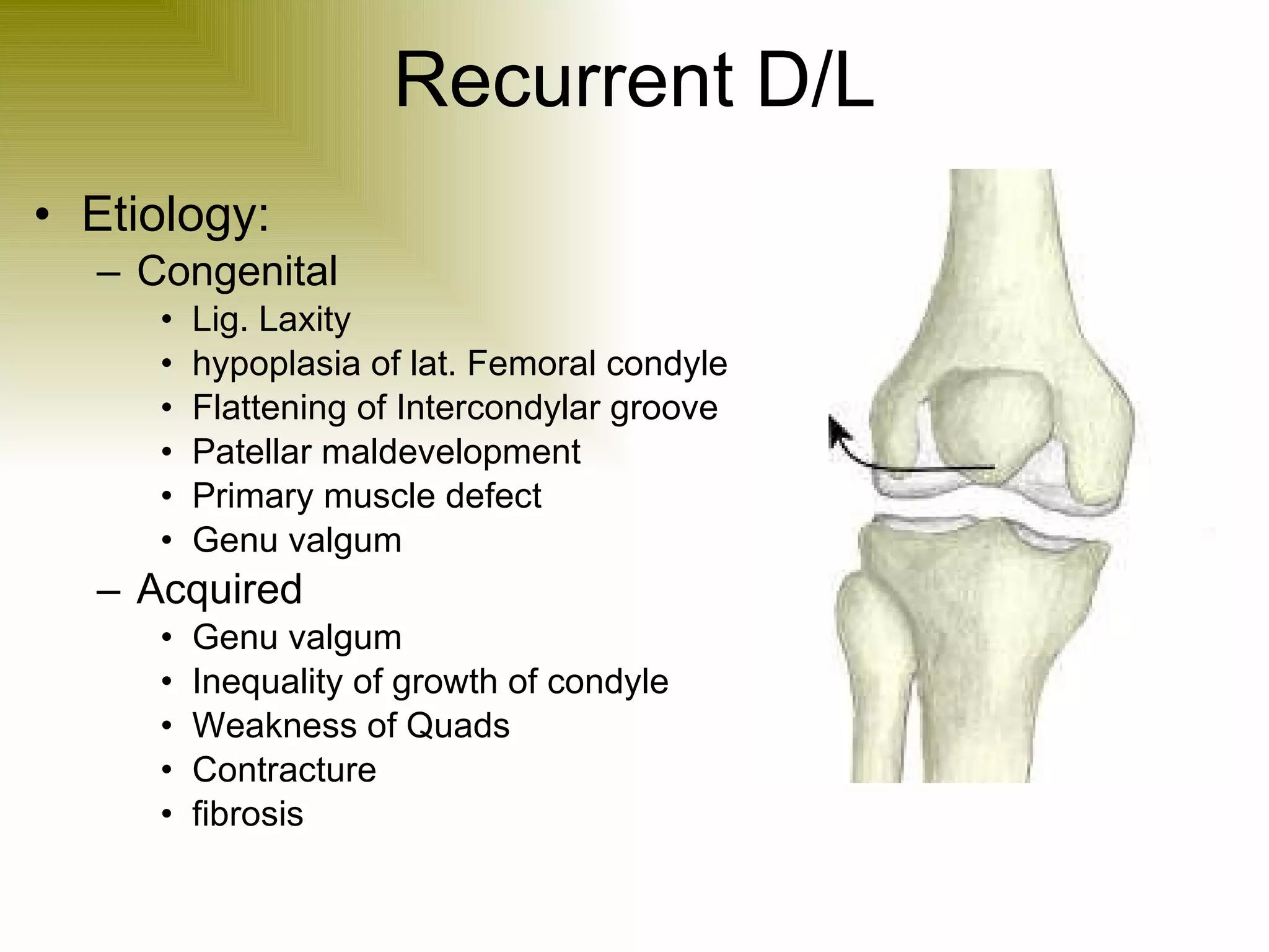 Recurrent D/L Etiology: Congenital Lig. Laxity hypoplasia of lat. Femoral condyle Flattening of Intercondylar groove Patellar maldevelopment Primary muscle defect Genu valgum Acquired Genu valgum Inequality of growth of condyle Weakness of Quads Contracture fibrosis 