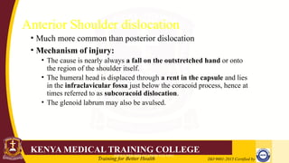 Fall Onto R Shoulder DISLOCATION OF THE SHOULDER.pptx well explained | PPTX