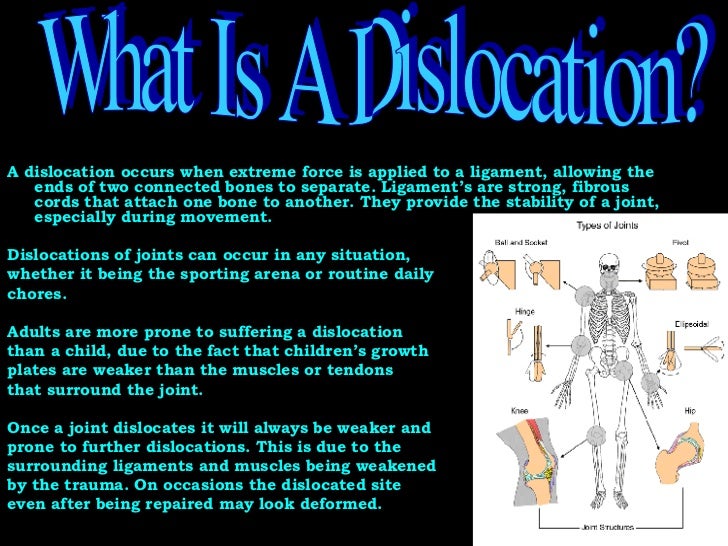 Dislocations