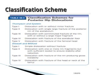Dislocations of Lower limb orthopedic ppt | PPT