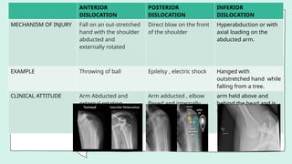 ANTERIOR
DISLOCATION
POSTERIOR
DISLOCATION
INFERIOR
DISLOCATION
MECHANISM OF INJURY Fall on an out-stretched
hand with the shoulder
abducted and
externally rotated
Direct blow on the front
of the shoulder
Hyperabduction or with
axial loading on the
abducted arm.
EXAMPLE Throwing of ball Epilelsy , electric shock Hanged with
outstretched hand while
falling from a tree.
CLINICAL ATTITUDE Arm Abducted and
external rotation
Arm adducted , elbow
flexed and internally
rotated
arm held above and
behind the head and is
unable to adduct arm
 
